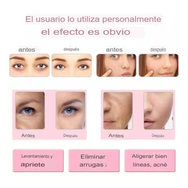 Masajeador elevador facial rejuvenecedor
